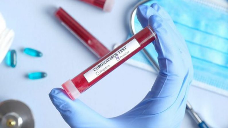 Coronavirus, il bollettino nazionale: calano i morti (437), nessuna regione ancora a zero contagi