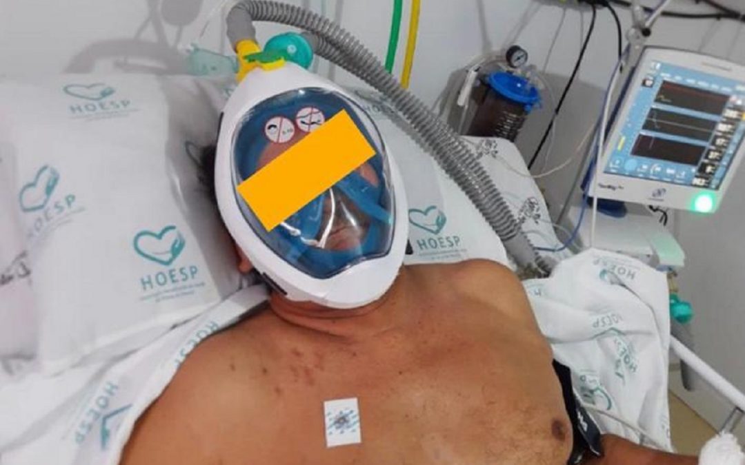 Uno dei pazienti ricoverati con la maschera trasformata in respiratore