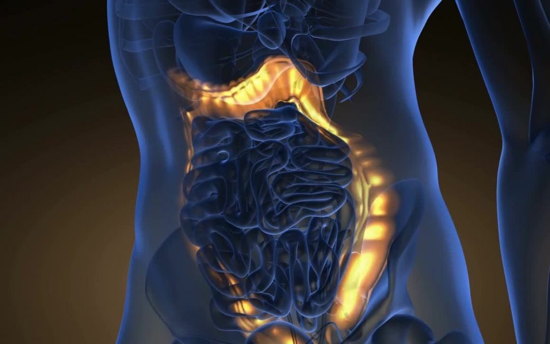 Tumore del colon: microbiota responsabile delle metastasi al fegato